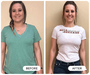 Before After 2