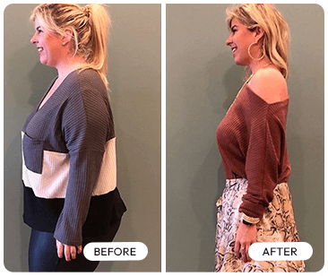 Before After 5