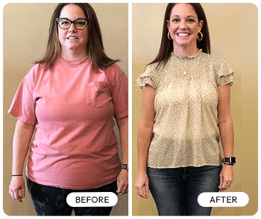Before After 3